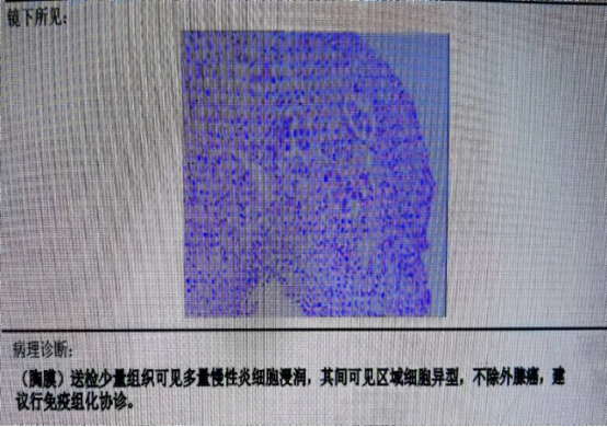 4469419d1b994ec6828f9bf83b2fa9dc.png