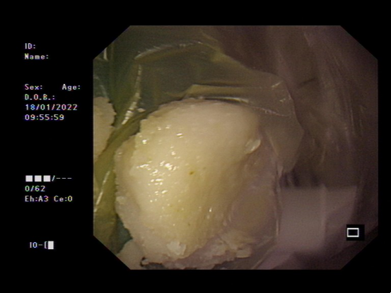 fdeab4cc35c148b3be4616f436ec4f5b.png