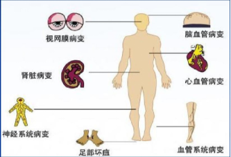 2db7565a54274fc08d6998f7a9bc5fd4.png