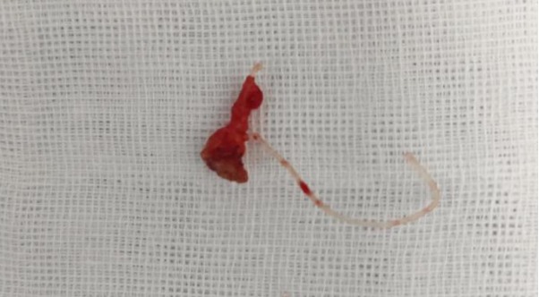 2781de5c-5bb8-443d-a751-9a66747b7d4e.jpeg 2781de5c-5bb8-443d-a751-9a66747b7d4e.jpeg